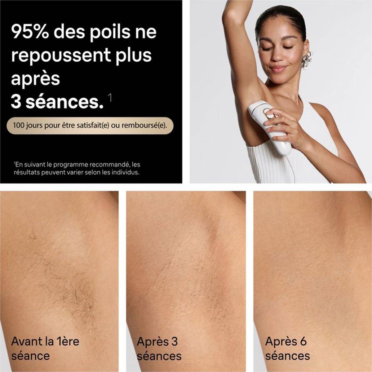 Braun - Épilateur à lumière pulsée IPL SkinProtect blanc et or Silk-expert Pro 5 PL5221 - Braun - Image 5